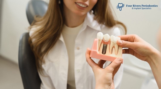 Woman looking at dental implant model
